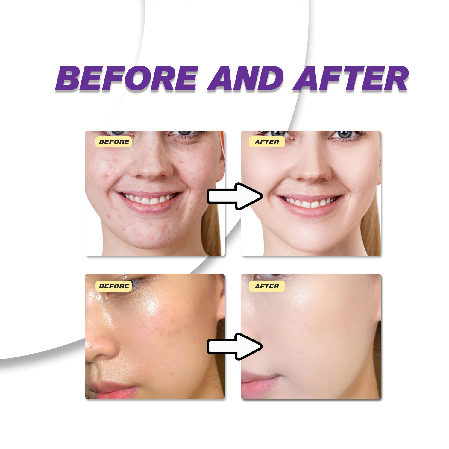Creme Suave de Ácido Azelaico  - Skincare Skintific avaliação e preço