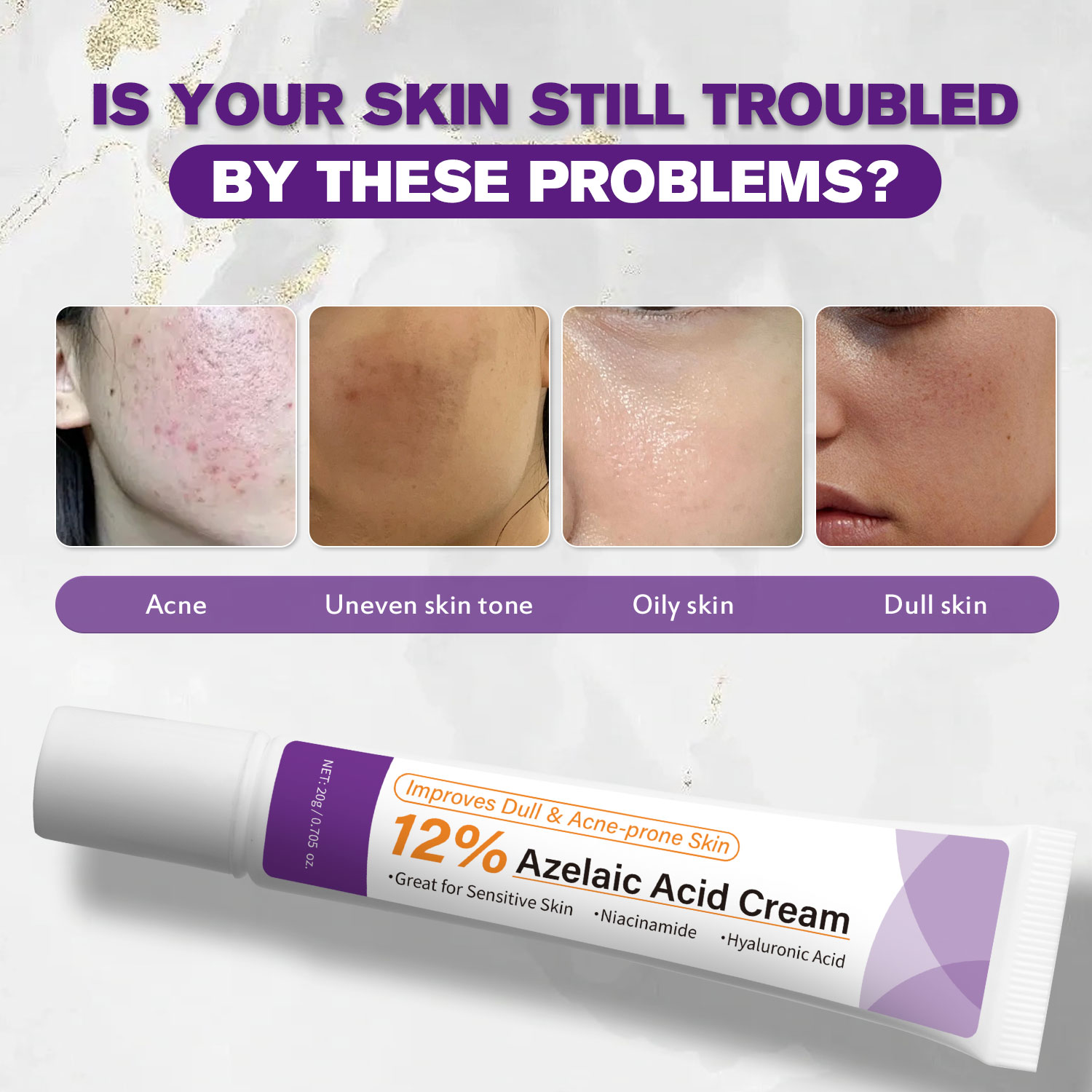 Creme Suave de Ácido Azelaico  - Skincare Skintific avaliação e preço