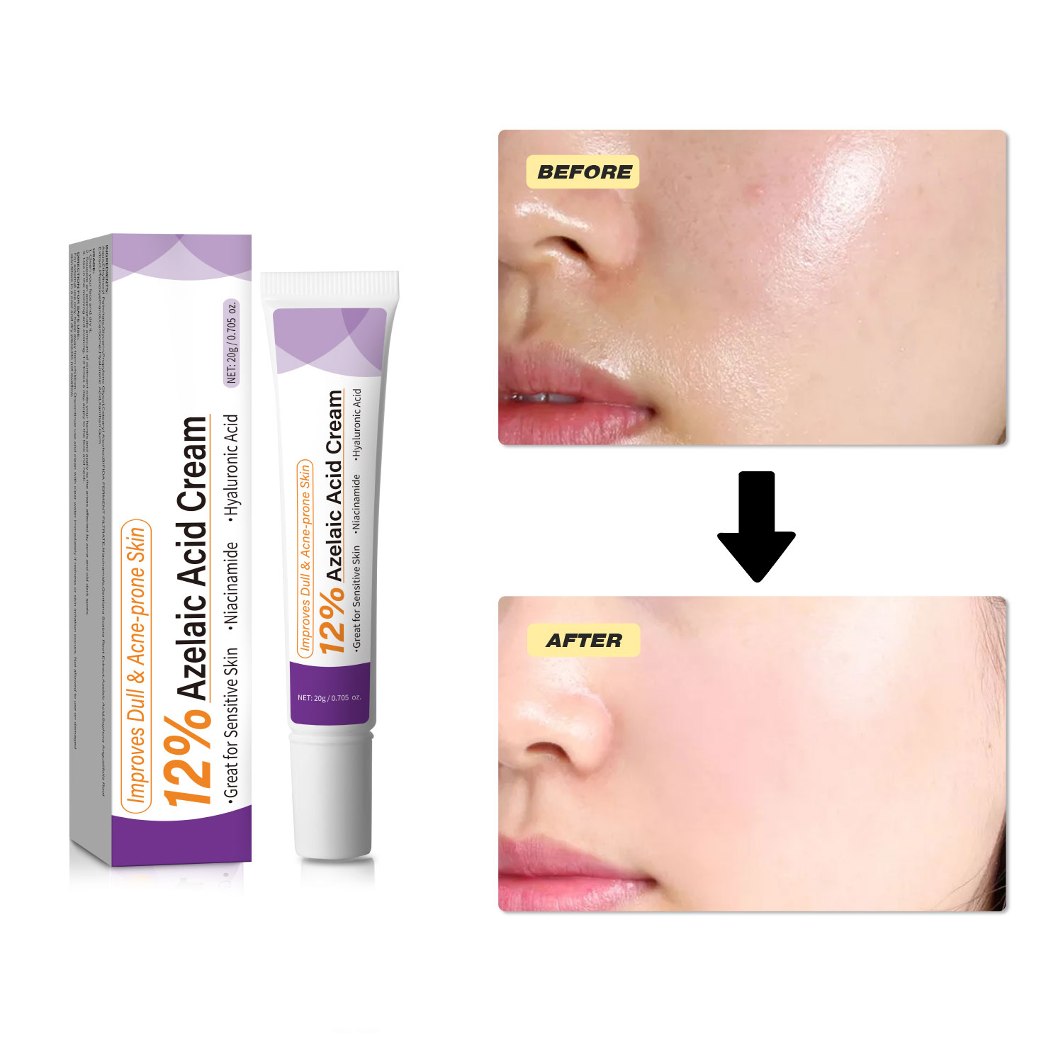 Creme Suave de Ácido Azelaico  - Skincare Skintific avaliação e preço